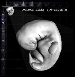 13-hindbrain-day40