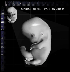 18-intestines_recede-day53