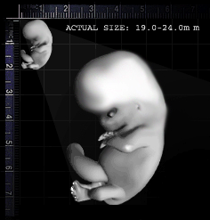 19-cartilage_forms-day55
